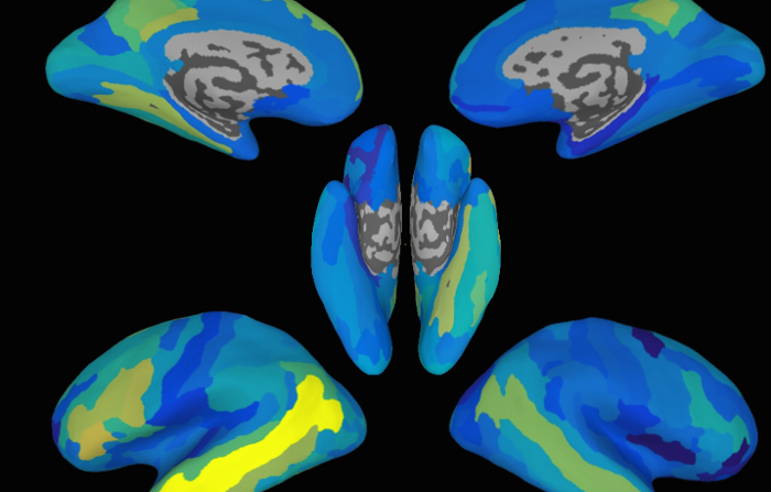 Brain scan figure