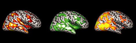 The fMRI scan represents correlations in neural activity between children and adults, in the middle between children and other children, and on the right between adults and other adults. Such neural maps, says University of Rochester cognitive scientist Jessica Cantlon, reveal how the brains neural structure develops along predictable pathways as we mature.