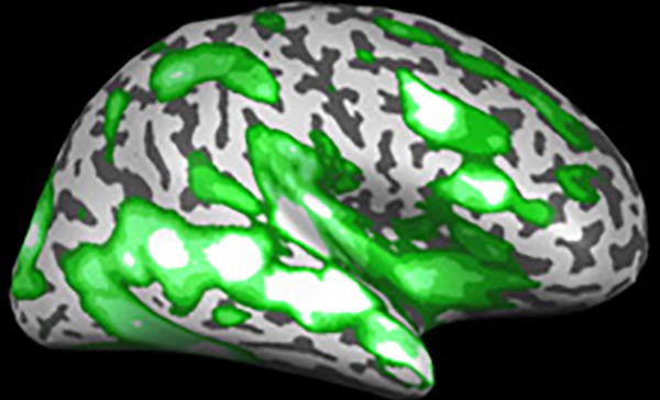 Brain and Cognitive Sciences