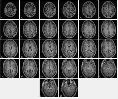 lots of images of individual brain scans